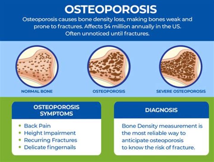 What's worse osteoarthritis or osteoporosis?