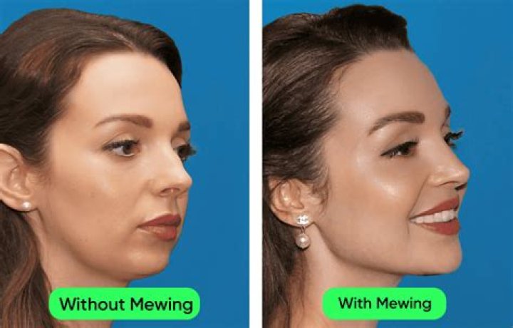 When do cheekbones stop growing?