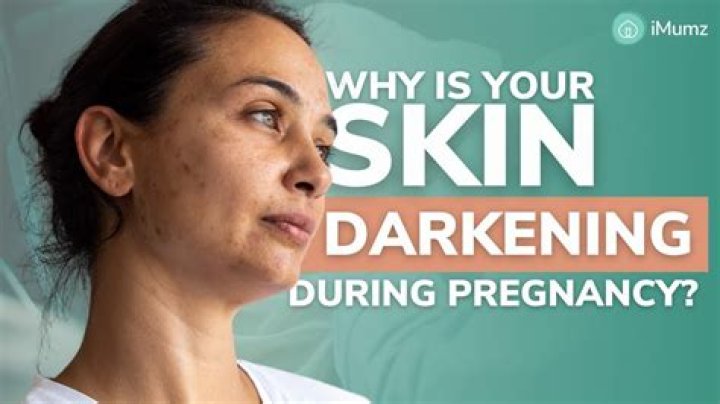 When do your areolas darken during pregnancy?