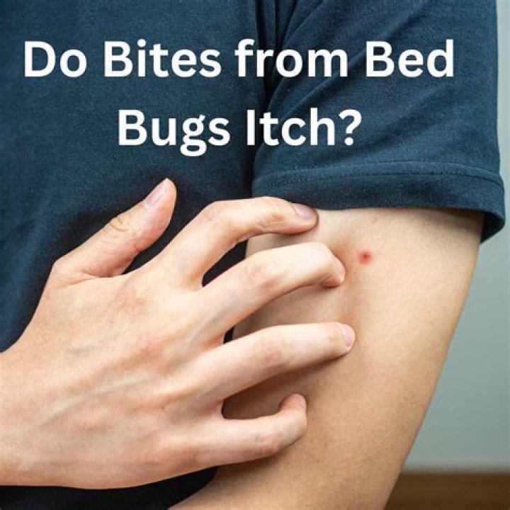 Where do bed bugs bite you the most?