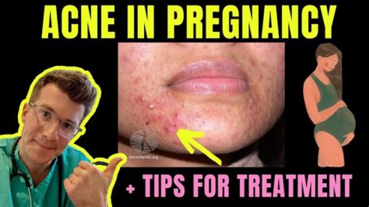 Where do pregnancy pimples appear?