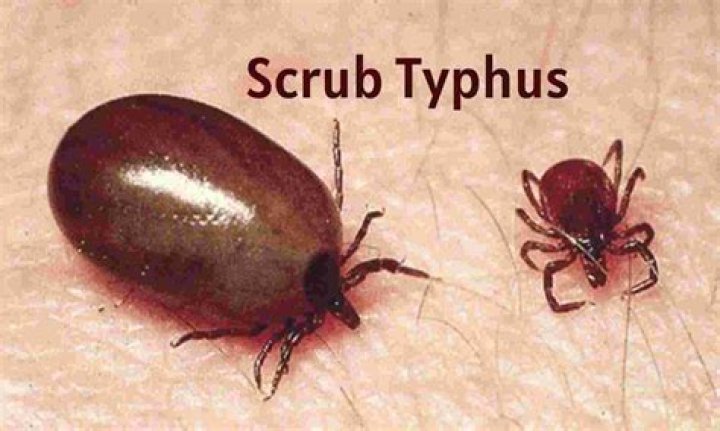 Where is typhus most commonly found?