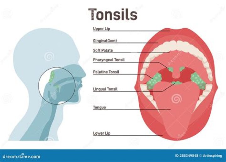 Where is your tonsils in your throat?
