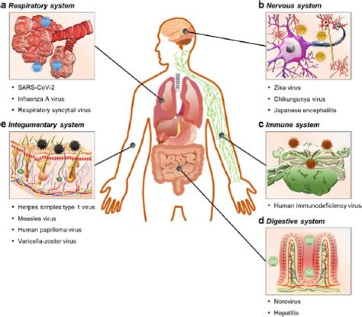 Which body systems are switched on by infection and cause organ dysfunction in sepsis?