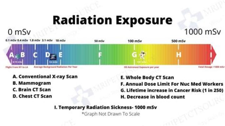 Which CT scan has the most radiation?