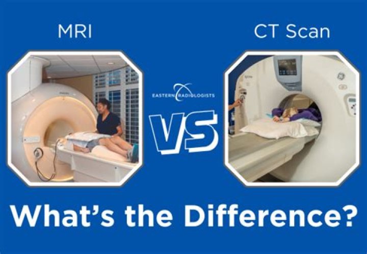 Which is better for stroke CT or MRI?
