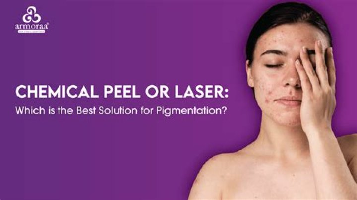 Which is more effective chemical peel or laser?