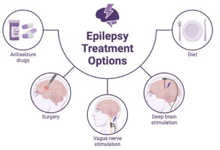 Which is the most common treatment for epilepsy?