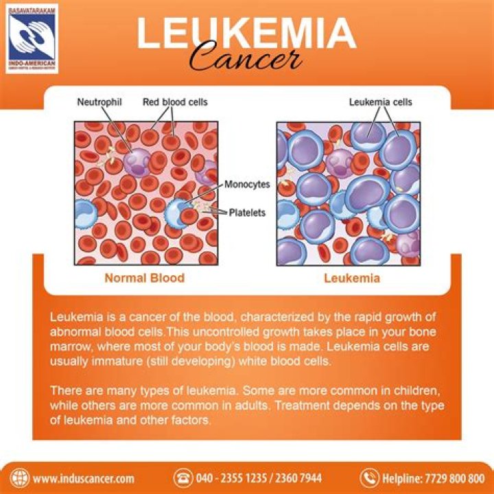 Which type of leukemia is most curable?