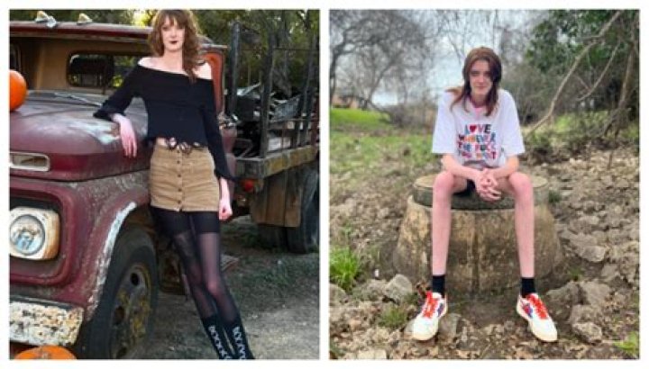 Who has the world's longest legs?