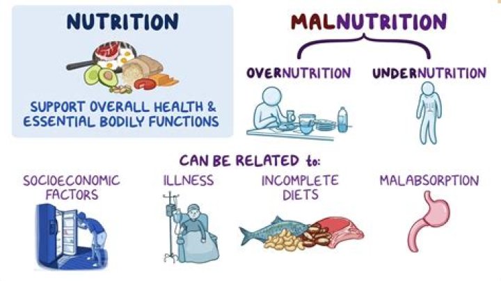 Who is most affected by malnutrition?