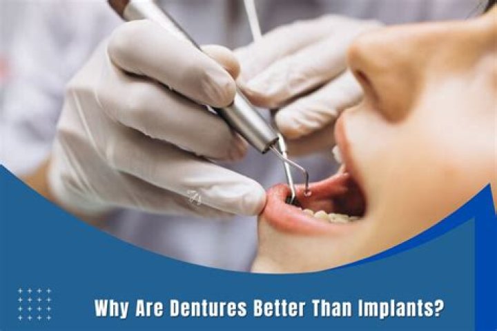 Why are dentures better than implants?