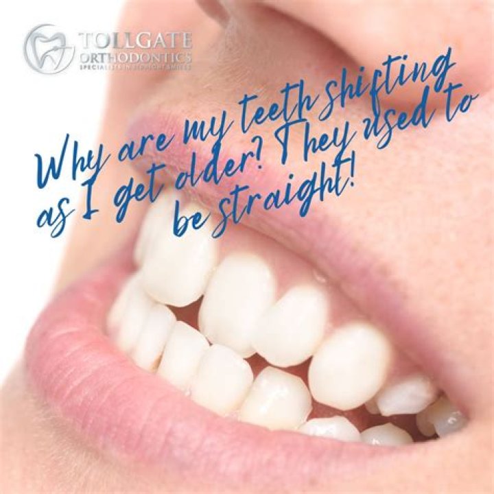 Why are my teeth shifting apart?