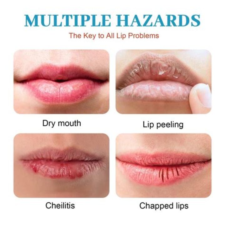 Why are there balls in my lips?
