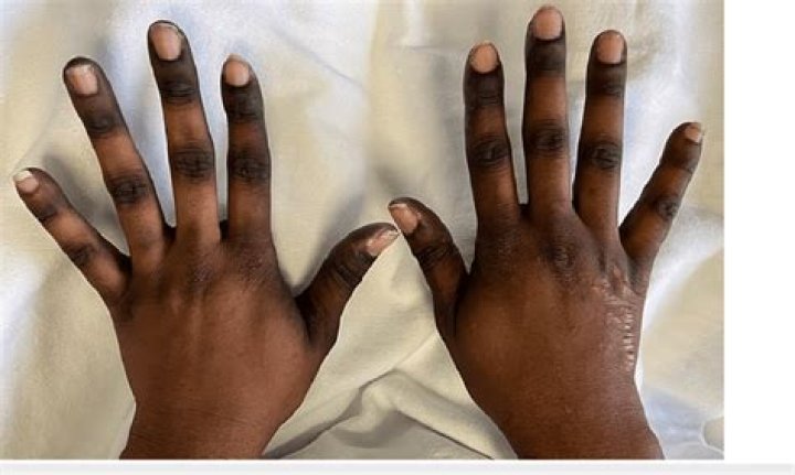 Why are Wanda's fingers black?