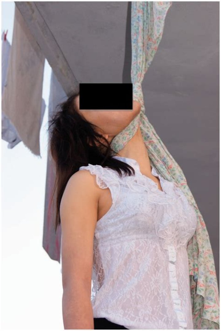 Why do babies hit themselves in the face?