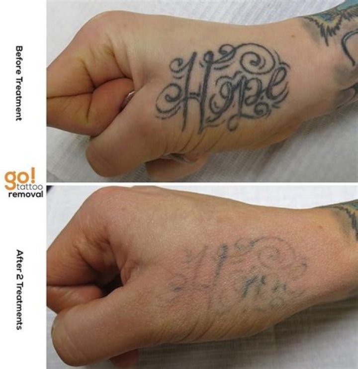 Why do hand tattoos fade?