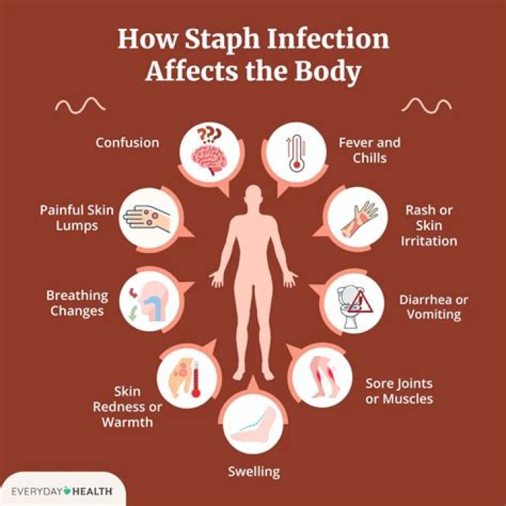 Why do I keep getting skin infections?