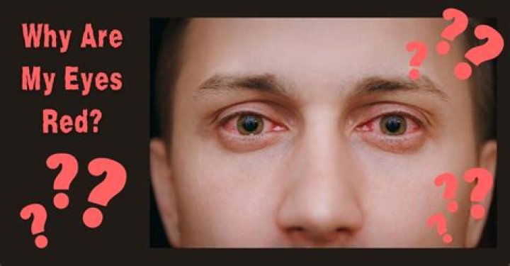 Why do I see red when I close my eyes?