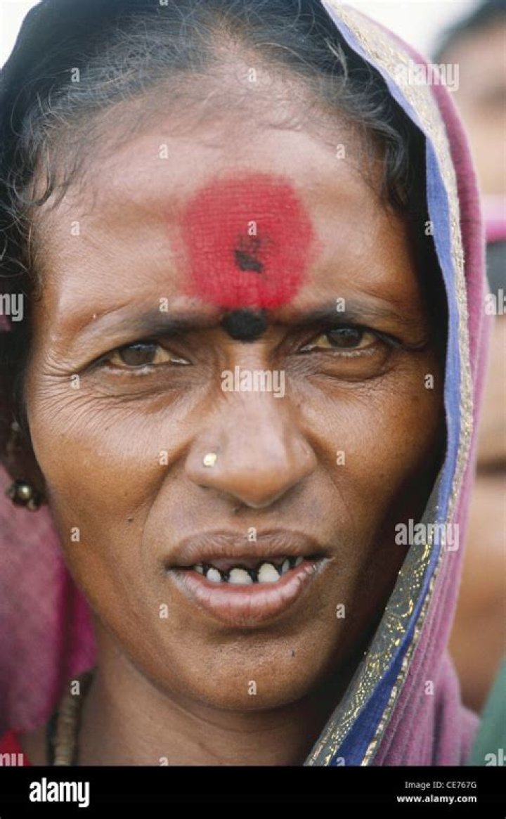 Why do Indian people have dark cheeks?