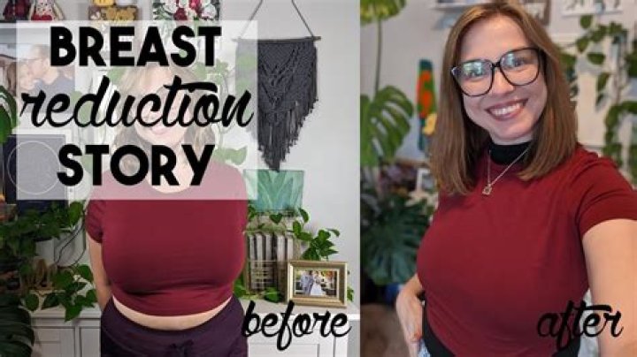 Why do my breast hang down?