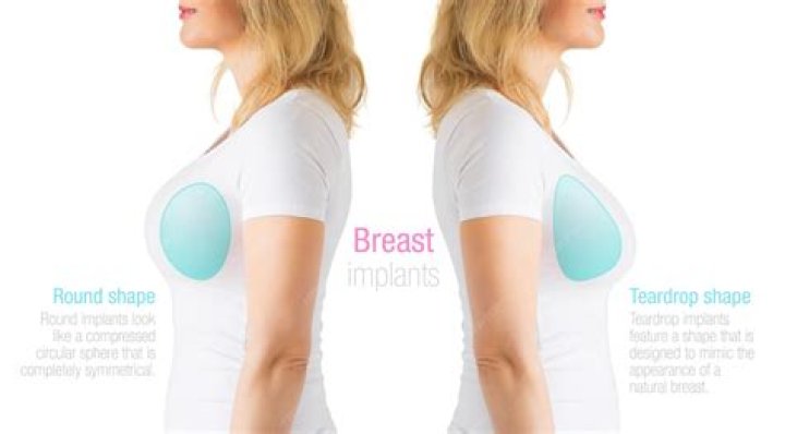 Why do my breast implants hurt 2 years later?