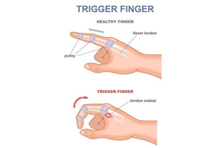 Why do my fingers swell when I bowl?