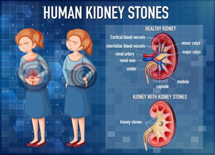 Why do my kidneys hurt when I'm on my period?