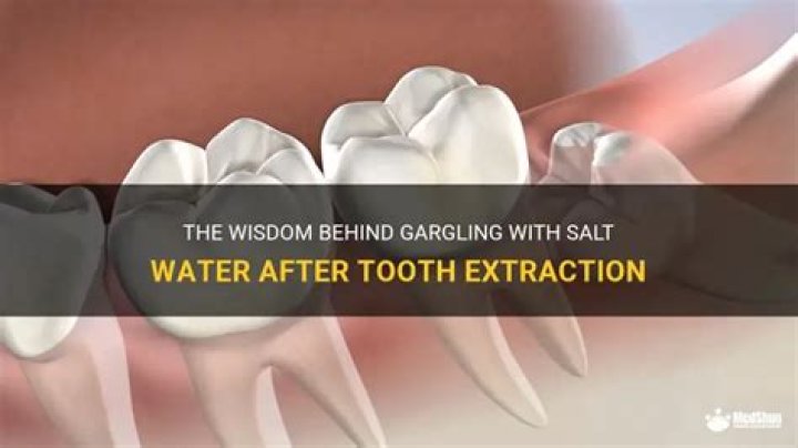 Why do people gargle with salt water after tooth extraction?