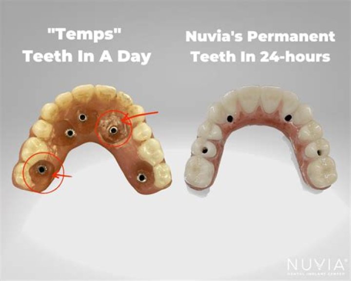 Why do we have 32 teeth?