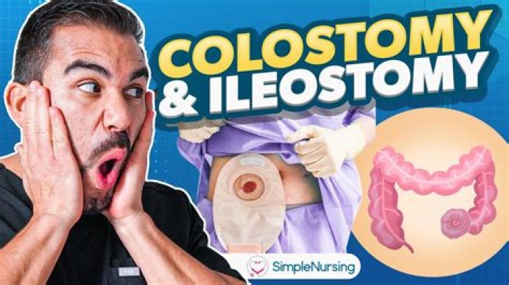 Why does my stoma burn?