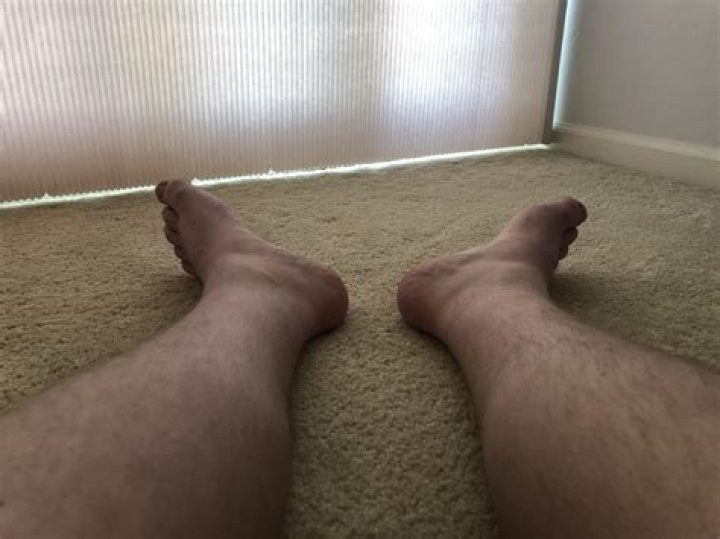 Why don't my toes lay flat?
