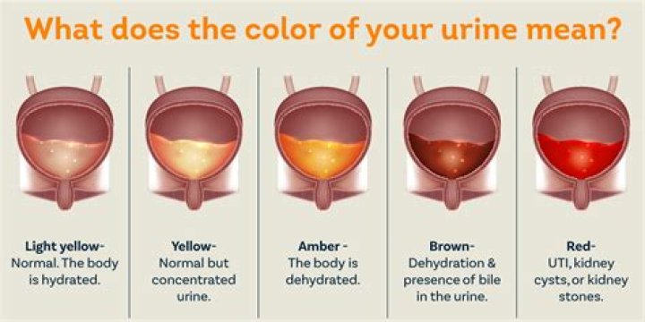Why is my pee coming out sideways male?