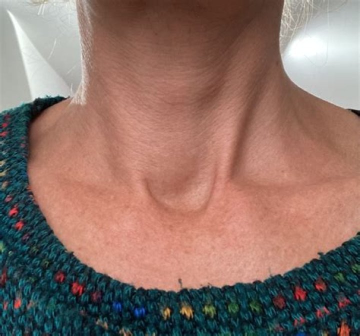 Why is one side of my neck swollen?