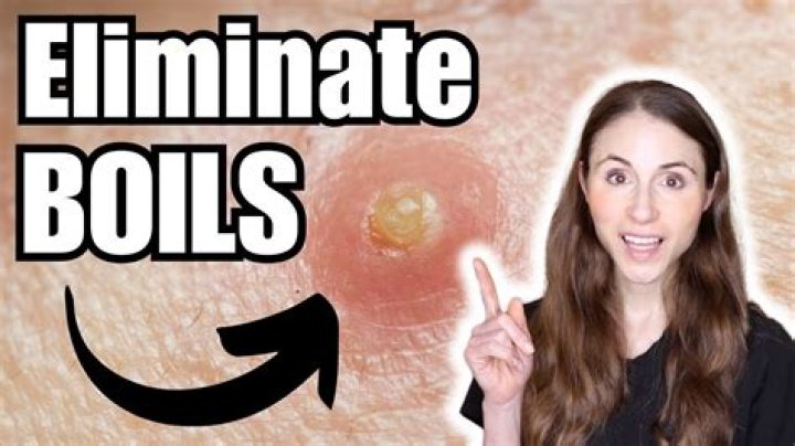 Why not pop a boil with a needle?