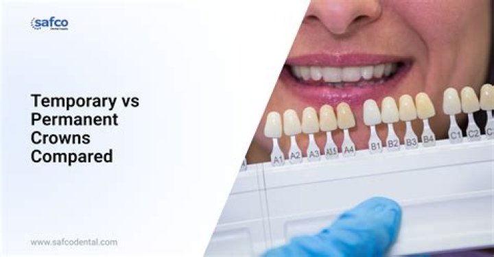 Why would a permanent crown fall off?