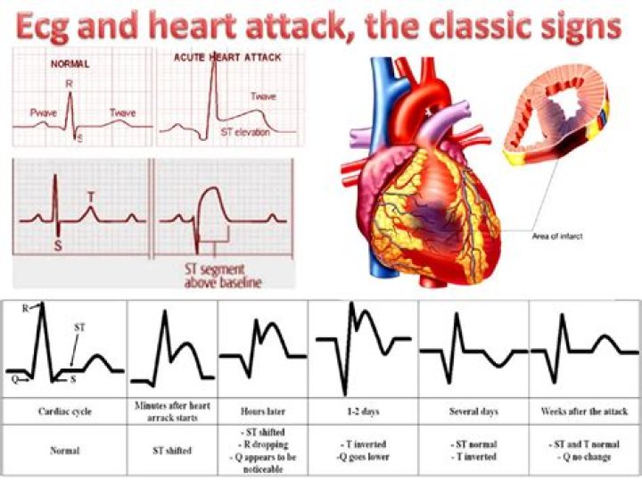 Will bloodwork show heart problems?