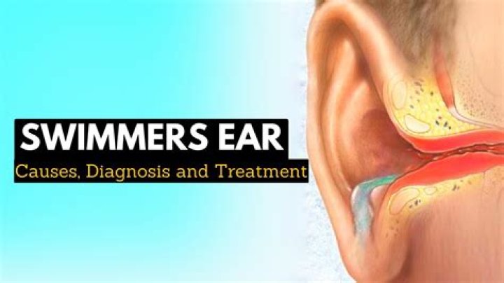 Will clogged ear go away by itself?