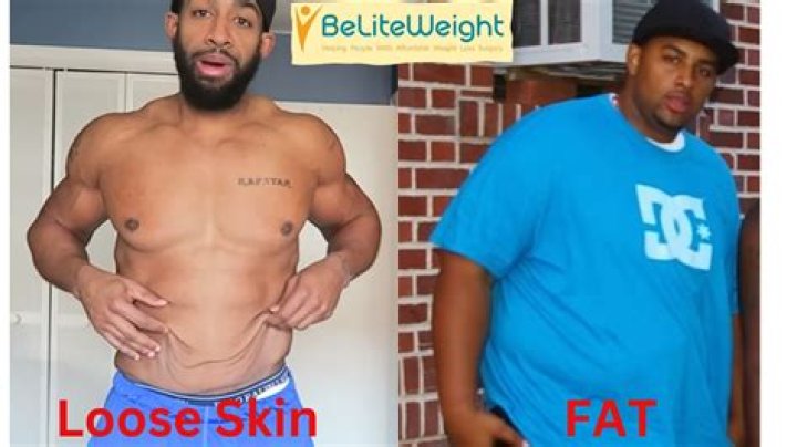 Will love handles eventually go away?
