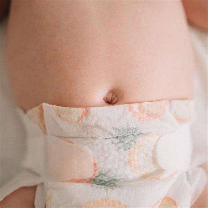 Will my baby have an innie or outie?