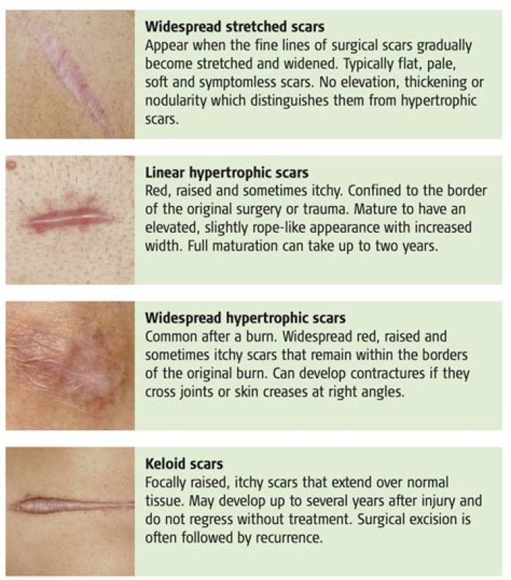 Will my pink scars ever fade?